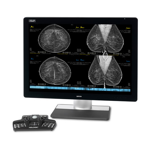 Hologic SecurView™ Breast Imaging Workstation in white background