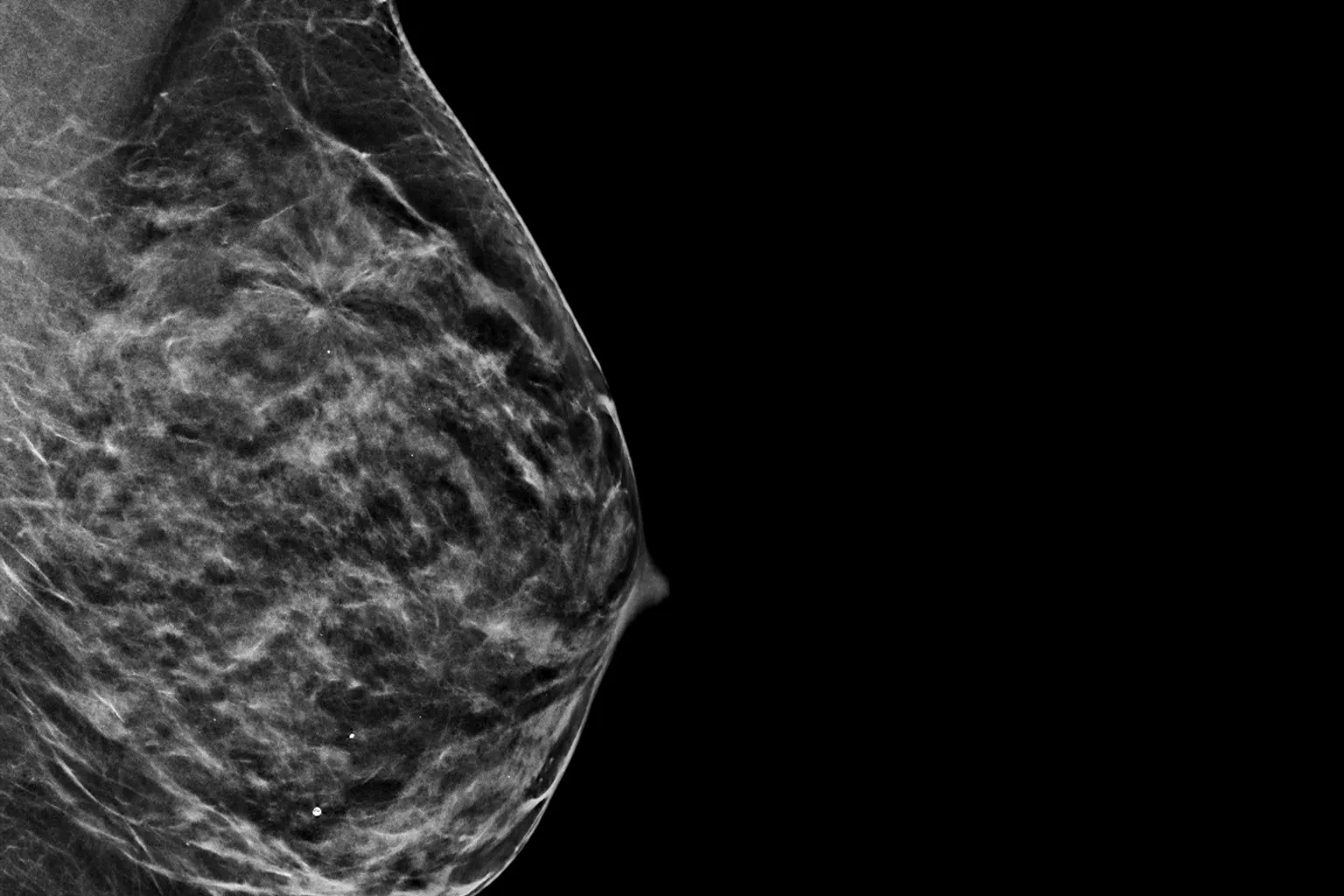 x-ray image of breast on black background