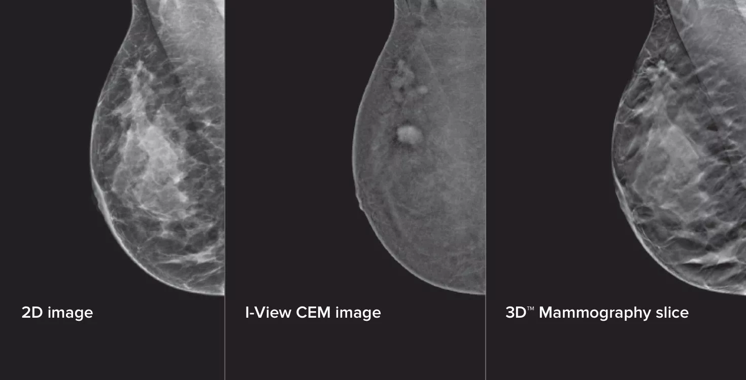 Breast imaging scans