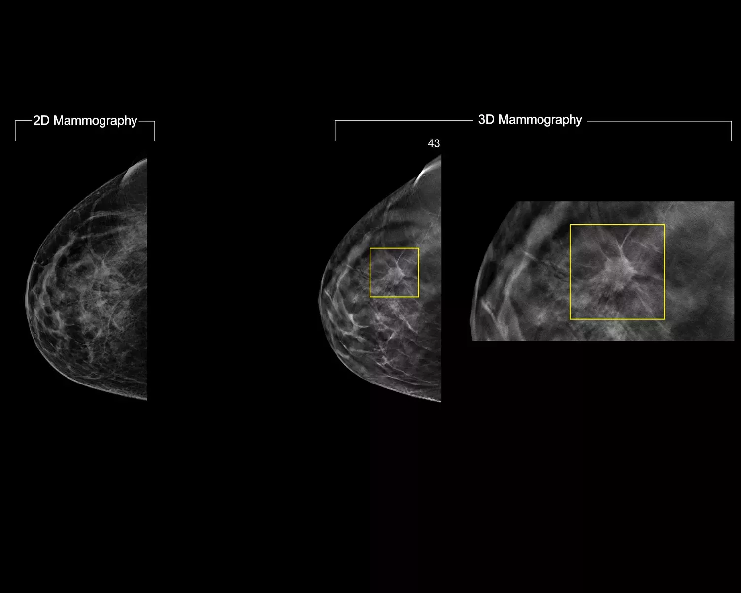 X-ray images