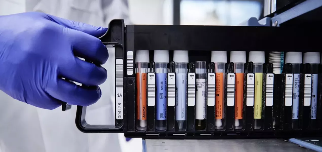 PCR tests in a rack held by a hand wearing gloves.